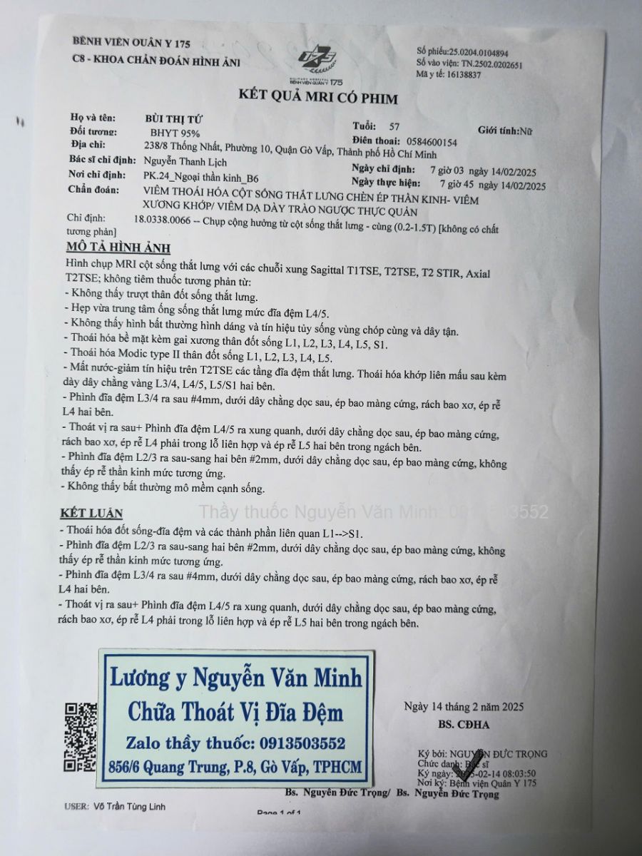 Rách bao xơ đĩa đệm